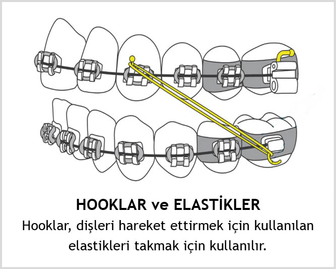 Hooklar, dişleri hareket ettirmek için kullanılan elastikleri takmak için kullanılır.